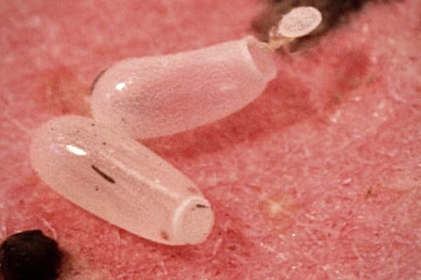 Super close up image of bed bug egg casing.
